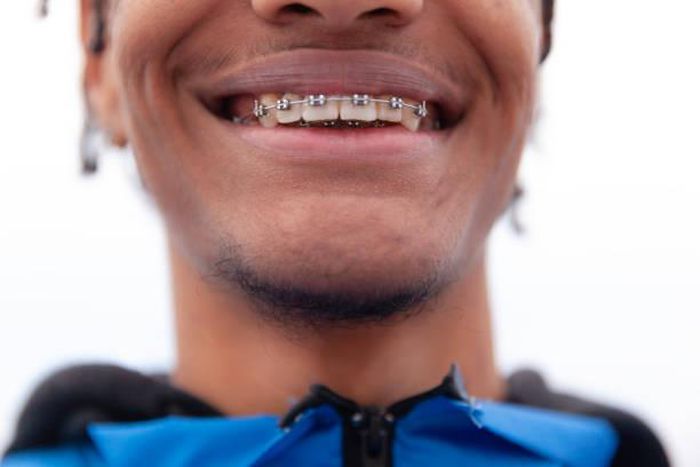 A person with braces
