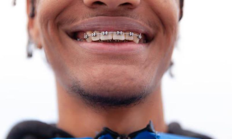 A person with braces