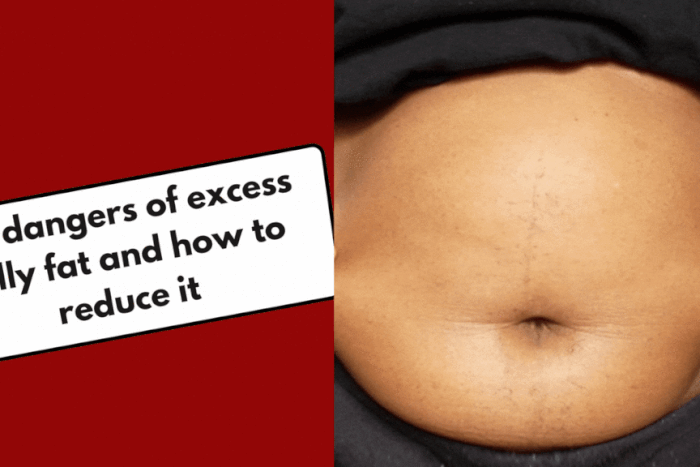 The dangers of excess belly fat
