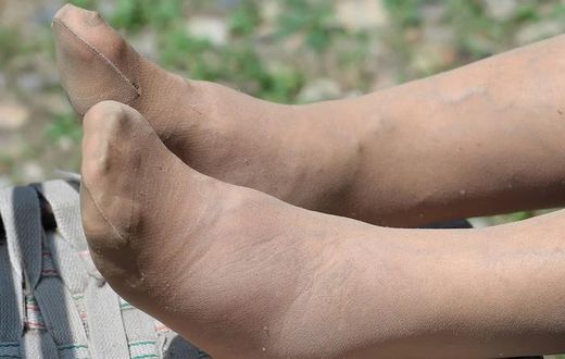 Awareness of some rather unusual symptoms of the disease remains low [Shutterstock]