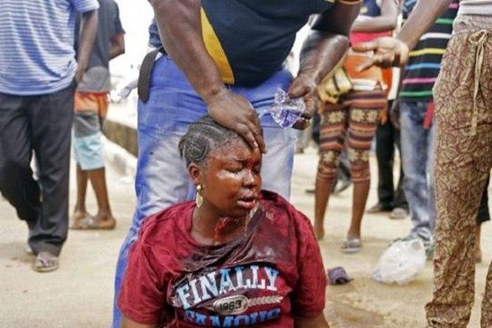 Beaten woman (For illustration purpose only)