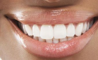 Woman with white teeth