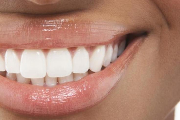 Woman with white teeth