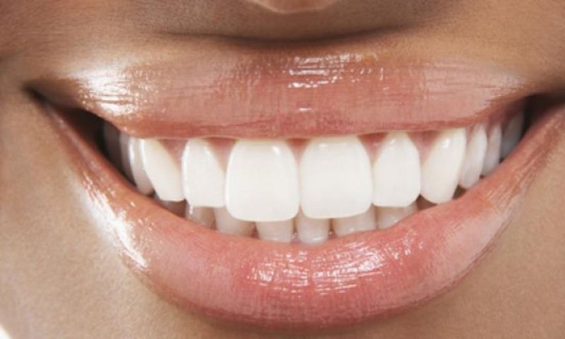 Woman with white teeth