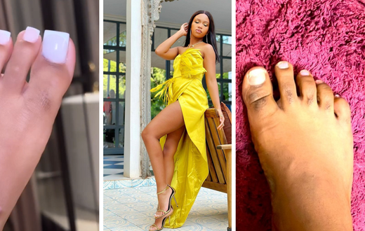 What you need to know about hairy toes/fingers: Gashumba shows off pedicure/COURTESY