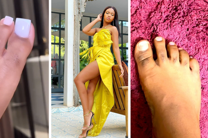 What you need to know about hairy toes/fingers: Gashumba shows off pedicure/COURTESY
