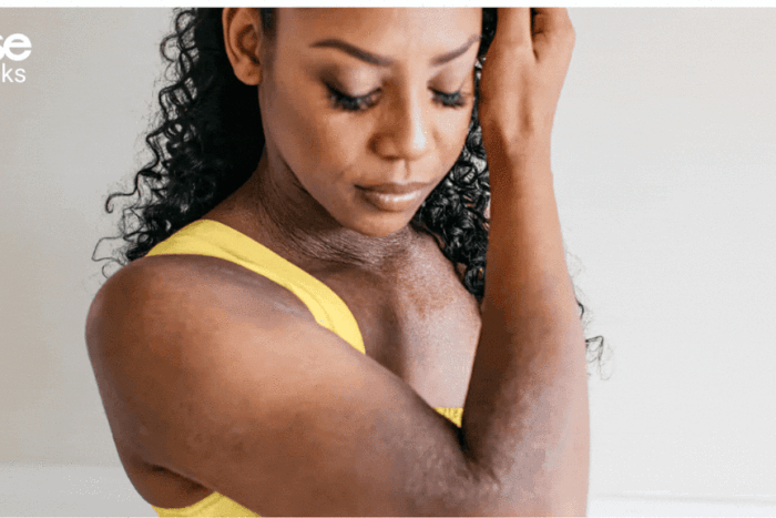 Best creams for eczema [greatist]