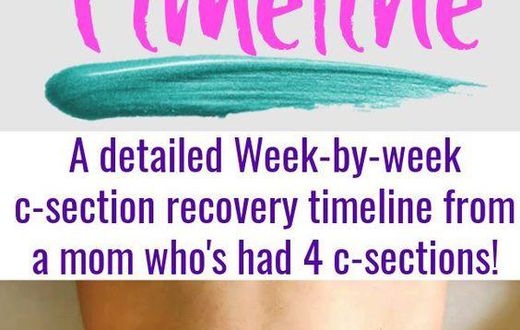 How to recover after a C-section [Pinterest]