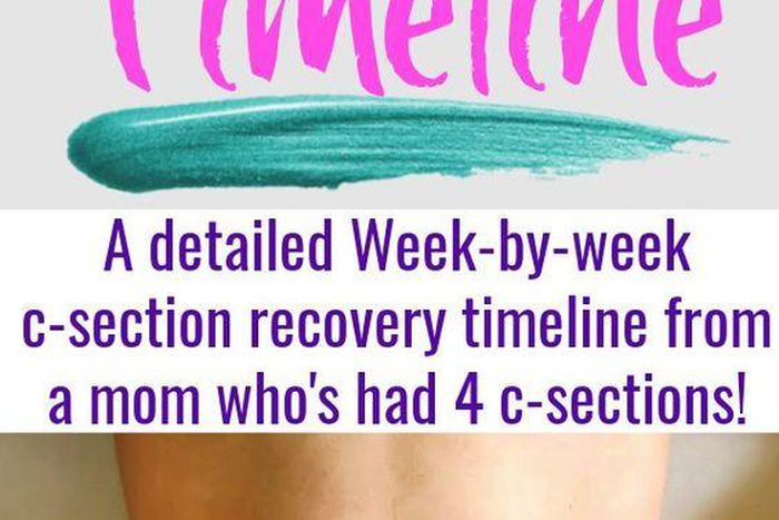 How to recover after a C-section [Pinterest]