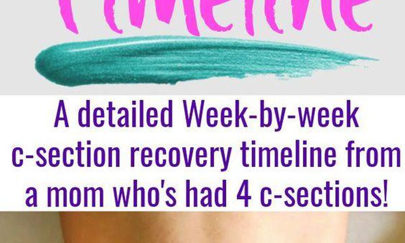 How to recover after a C-section [Pinterest]