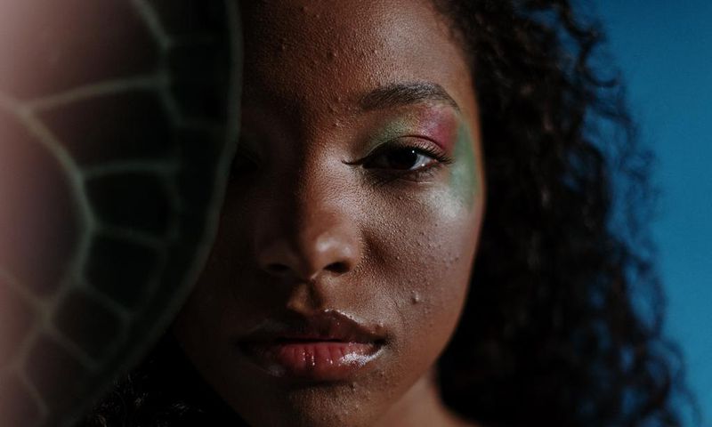 Triangle of death: Don't pop pimples in this body region/Pexels