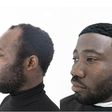 Remedies for men's receding hairline [Blackbeauty]