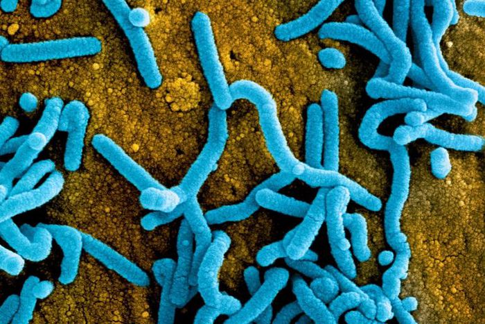 Particles of Marburg virus are shown in false color here.FR/NIH/NIAID/BSIP/Universal Images Group via Getty Image