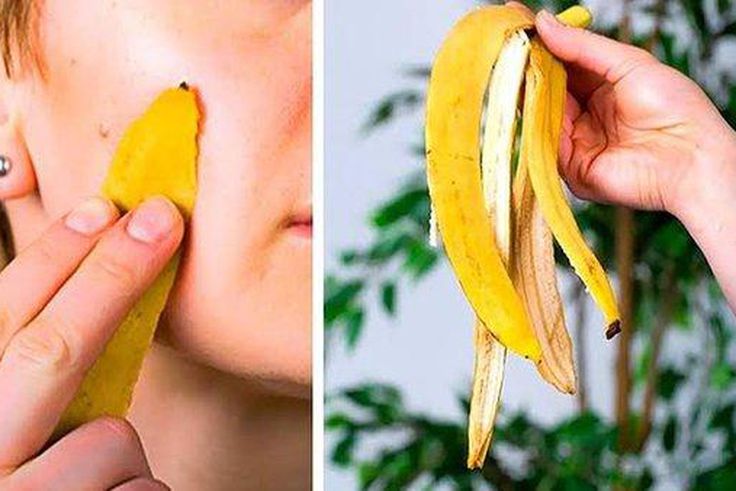 The benefits of banana peel are numerous [Quora]