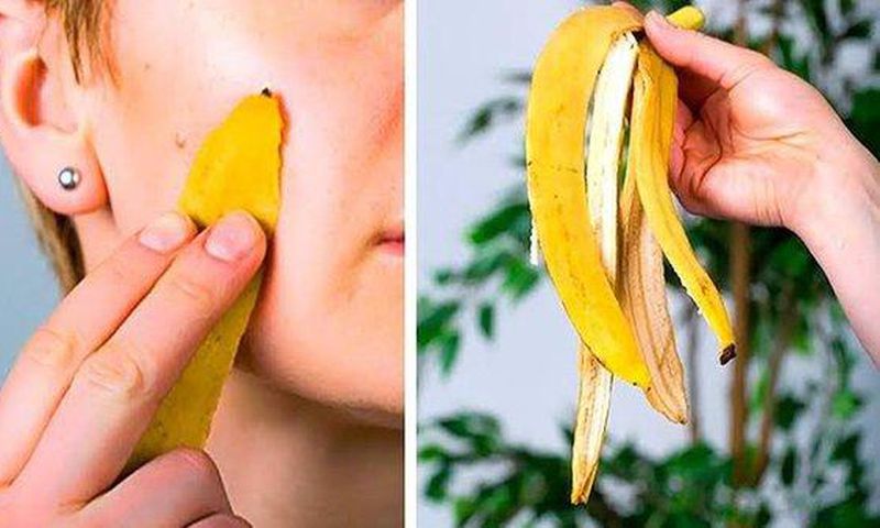 The benefits of banana peel are numerous [Quora]