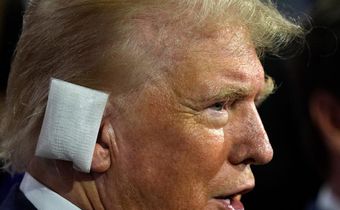 Former President Donald Trump sporting a huge bandage on the first day of the Republican National Convention in Milwaukee.Evan Vucci/AP