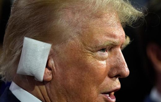 Former President Donald Trump sporting a huge bandage on the first day of the Republican National Convention in Milwaukee.Evan Vucci/AP