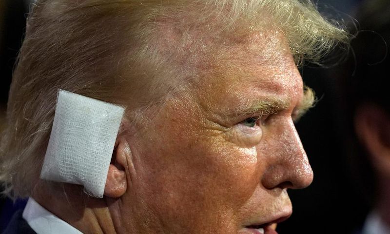Former President Donald Trump sporting a huge bandage on the first day of the Republican National Convention in Milwaukee.Evan Vucci/AP