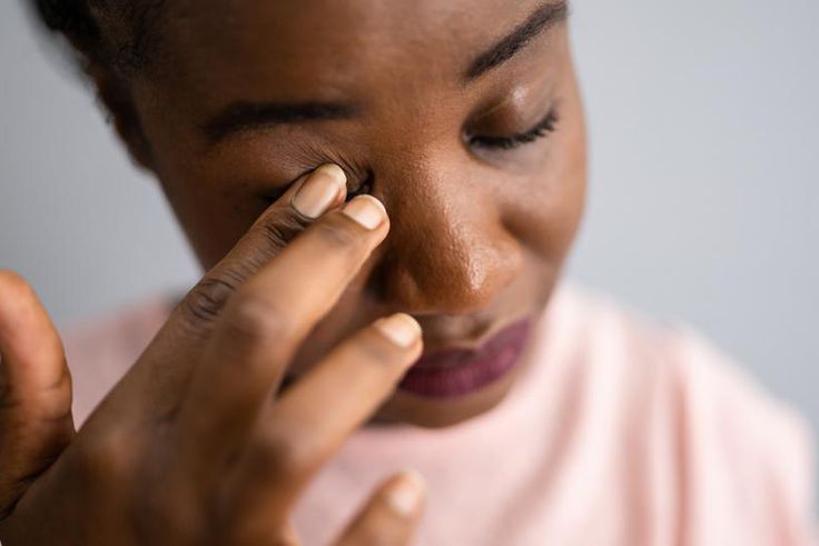 Conjunctivitis is very contagious, just like a common cold.