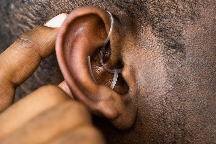 Hearing aid [UF Health]