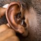 Hearing aid [UF Health]