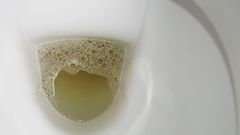 It's essential to pay attention to the characteristics of your urine.