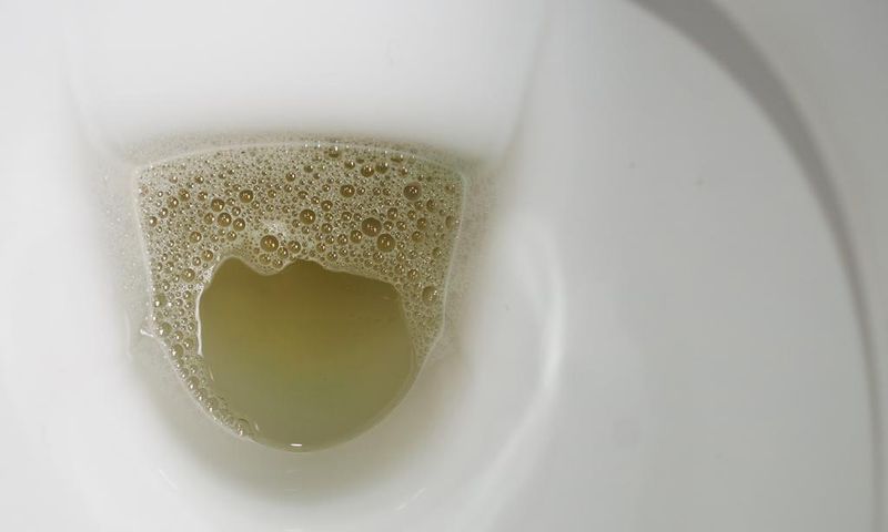 It's essential to pay attention to the characteristics of your urine.