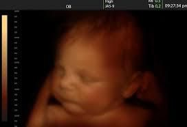 Your baby stats to hear more around 16 weeks [FirsstCryParenting]