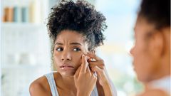 Let's debunk some acne myths [Allure]