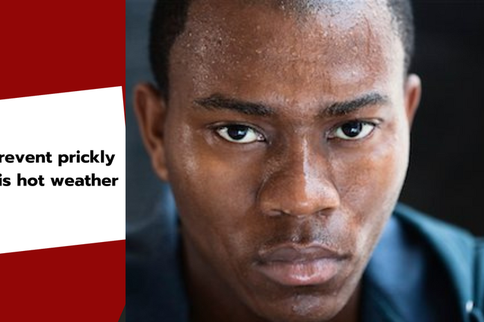 Best products for prickly heat