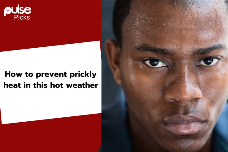 Best products for prickly heat