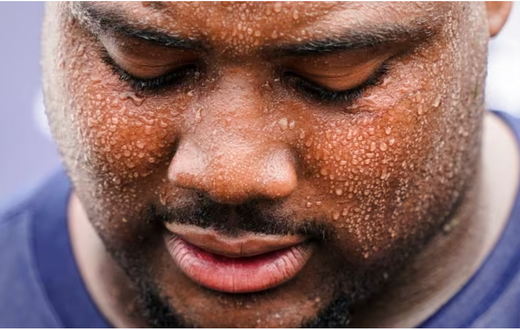 With the heat comes sweat [CBC]
