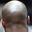 Bald man