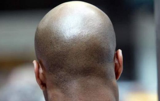 Bald man