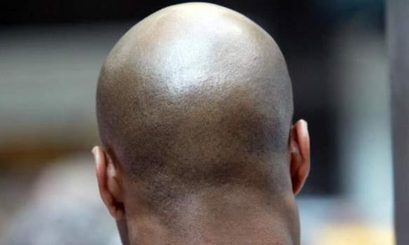 Bald man