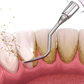 If plaque stays on your teeth for too long, it can harden into tartar