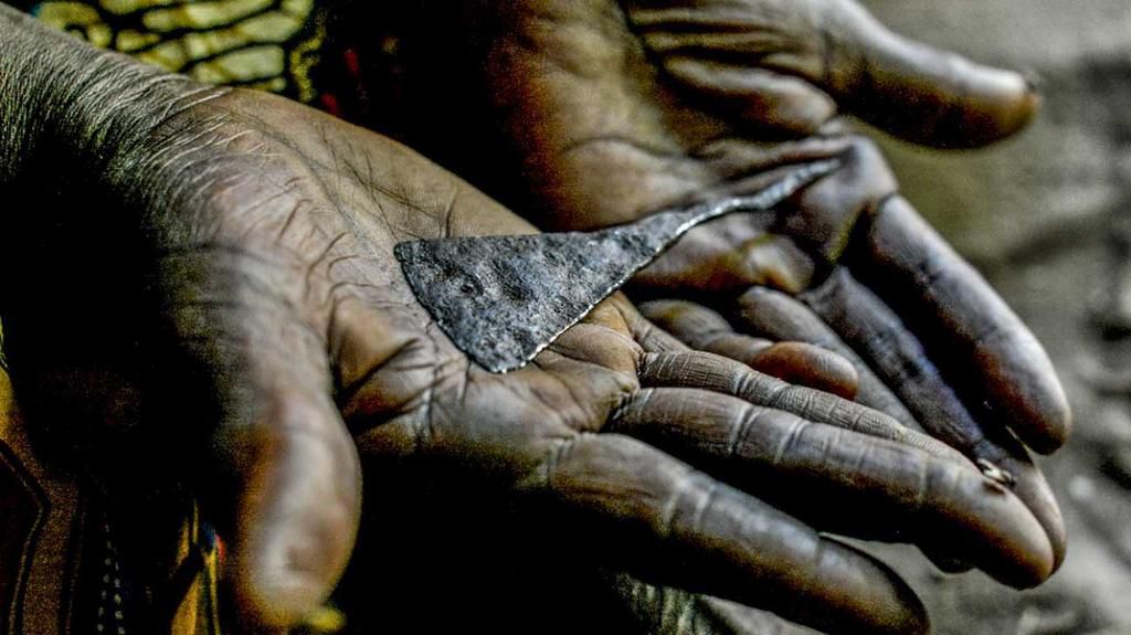 Female genital mutilation [healthline]