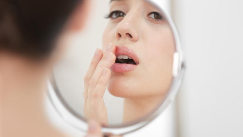 You may have herpes and not know [Abreva]