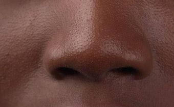 Nose [Shutterstock]