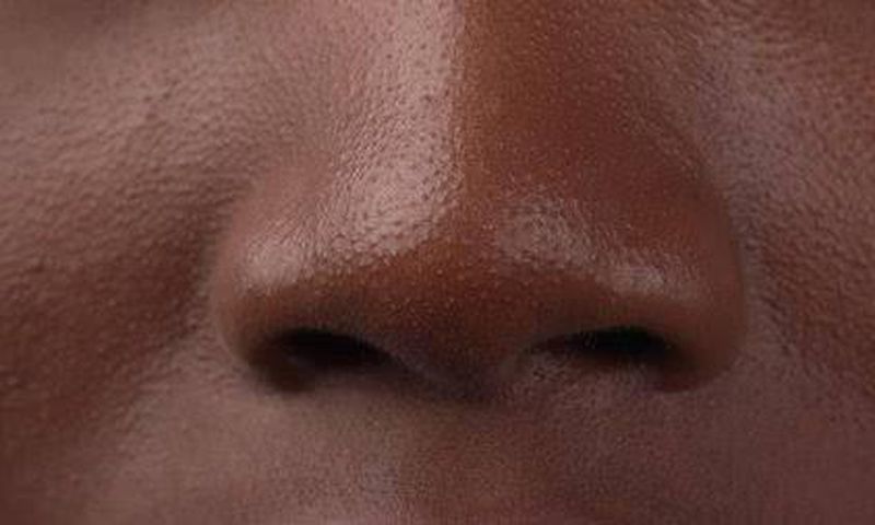 Nose [Shutterstock]
