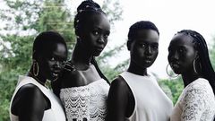 The South Sudanese, particularly the Dinka and Nuer ethnic groups, are known for their exceptionally deep, dark complexions