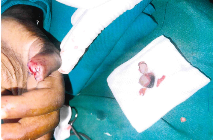 Late Katanga’s wife Molly sustained  injuries during the incident and was rushed to hospital in serious condition