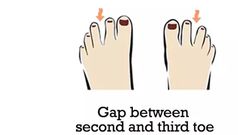 Gap between the second and third toes