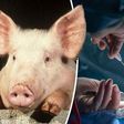 Kidney transplant done with pig's kidney [dailyexpress]