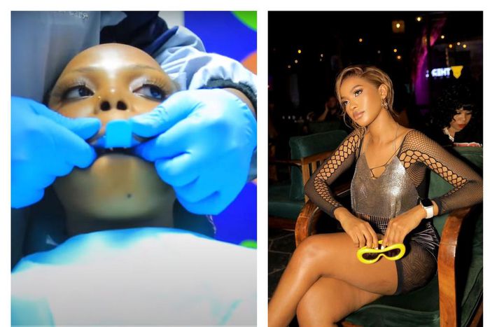 TikToker Goretti had her teeth fixed last weekend courtesy of Spice Diana