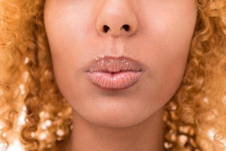 Signs of Herpes