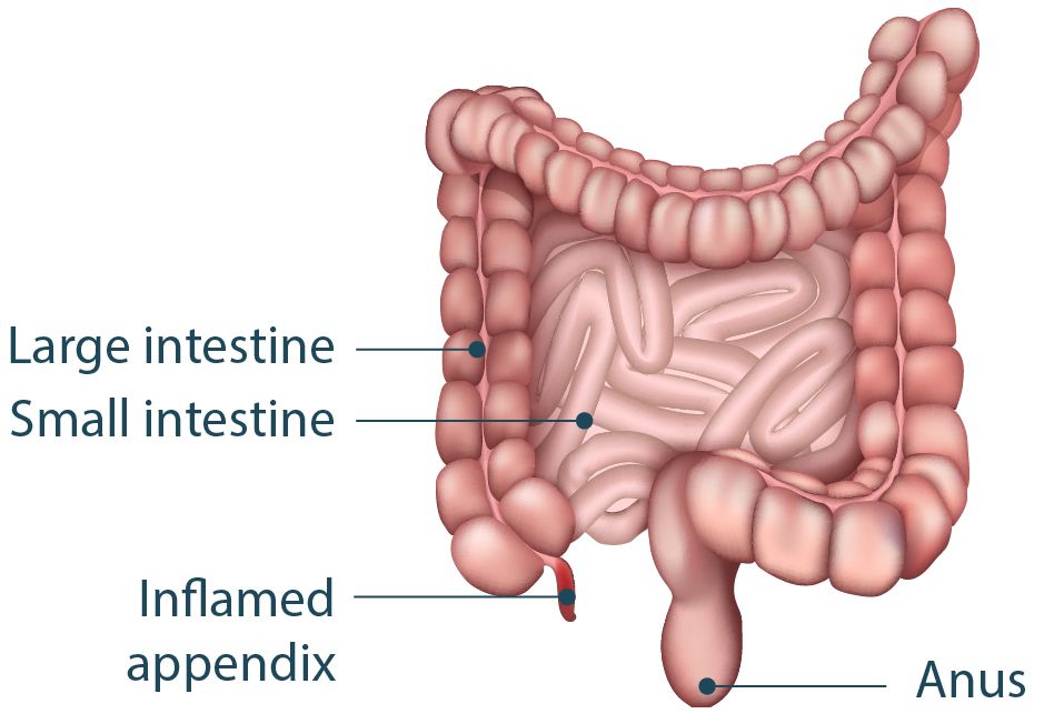 Diagram of an appendix