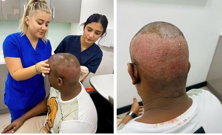 11 cosmetic surgeries common among Kenyan celebrities