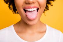 What your tongue says about your health: 7 signs you shouldn't ignore
