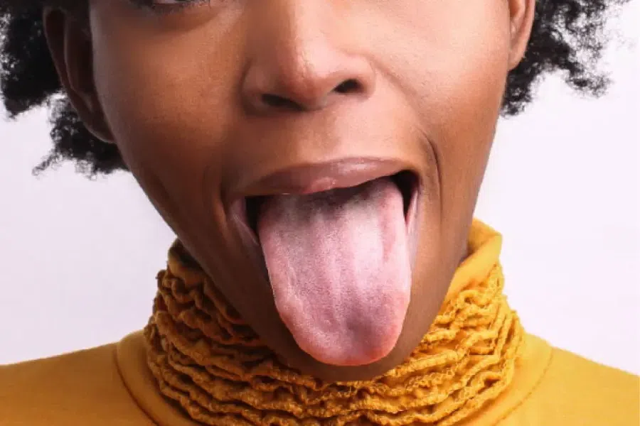 What your tongue says about your health: 7 signs you shouldn't ignore